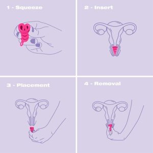 High Quality Teen Period Cup, Menstrual Cup for Beginners, First Time User - Image 3